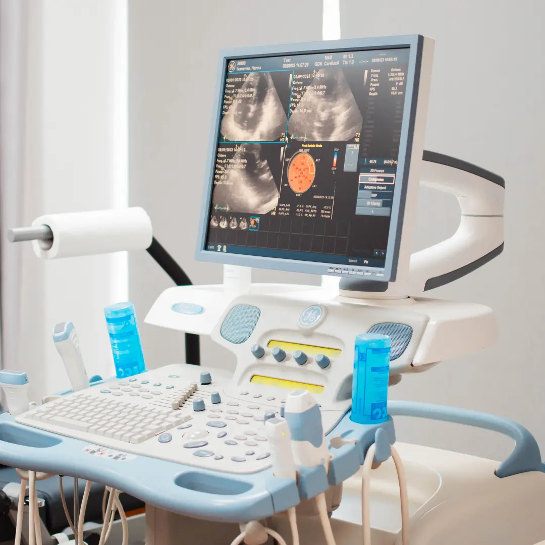 Ехокардіографія (УЗД серця)