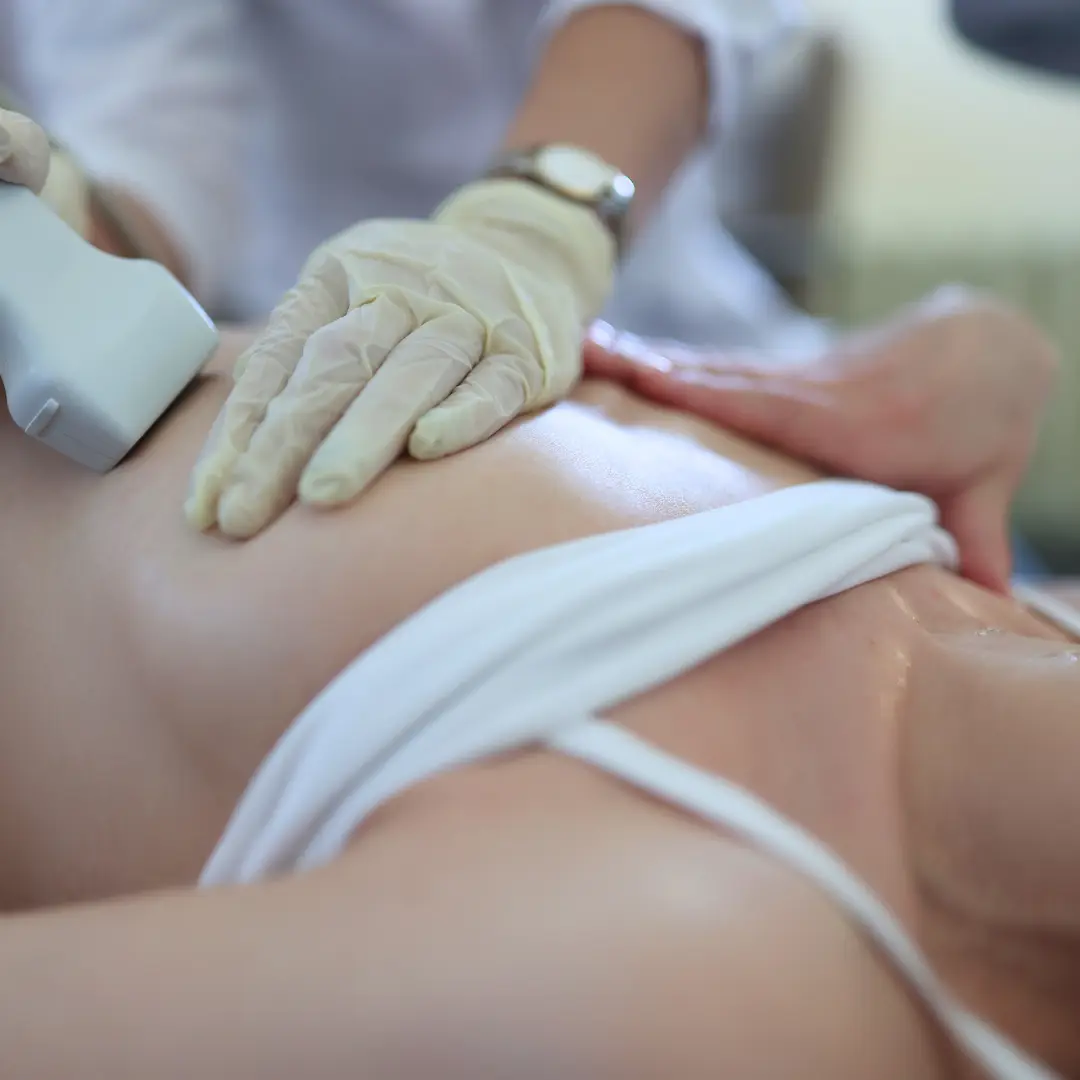 УЗД молочних залоз