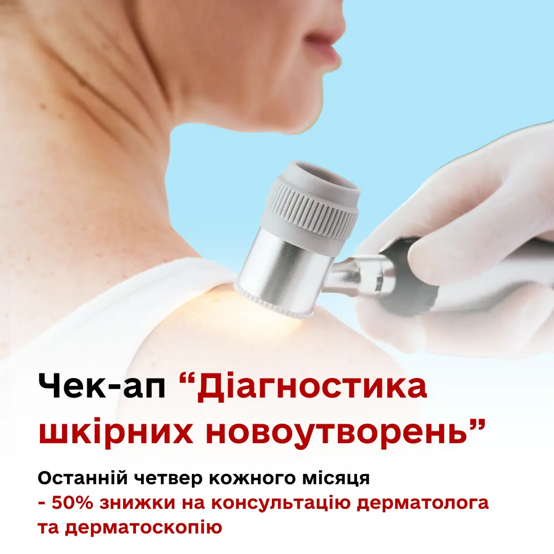 Дерматологічний чек-ап