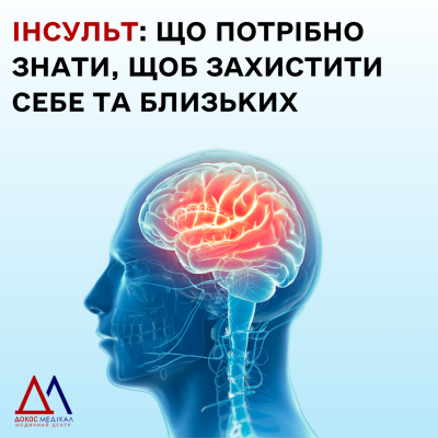 Інсульт: що потрібно знати, щоб вберегти себе та близьких