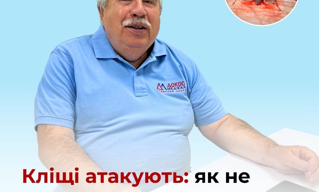 Сезон кліщів: що робити?
